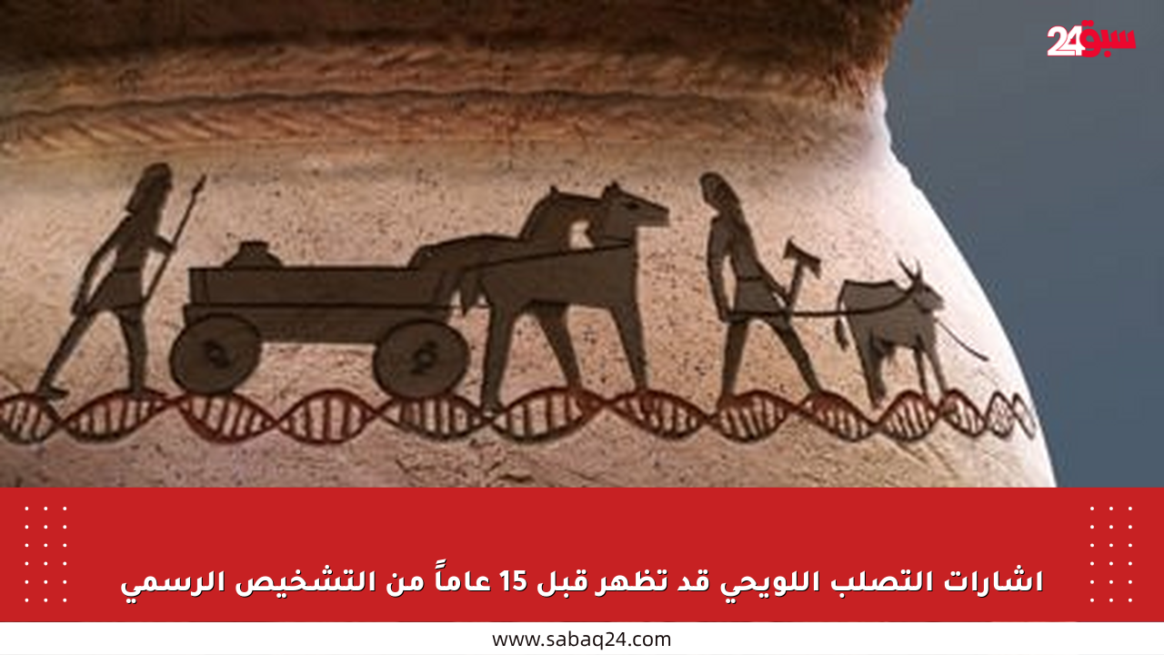 إشارات التصلب اللويحي قد تظهر قبل 15 عاماً من التشخيص الرسمي